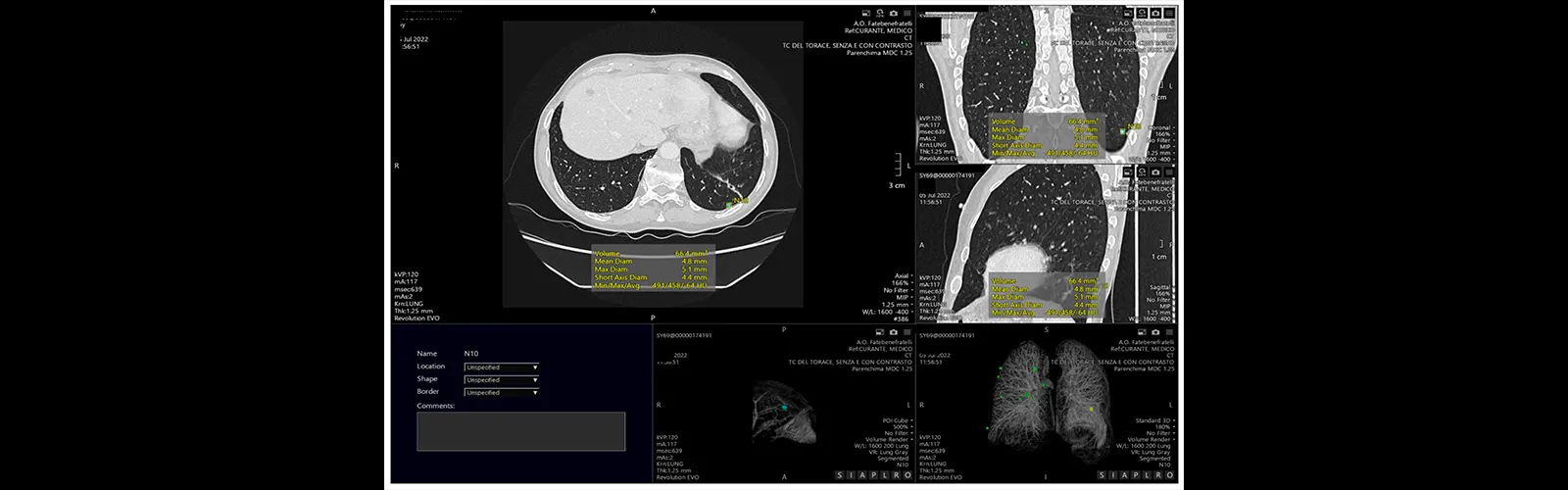 What Is The Role Of CT Chest 3D In Cancer Diagnosis?